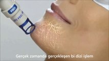 ClearLift Estetik Lazer Dr Mustafa Karataş