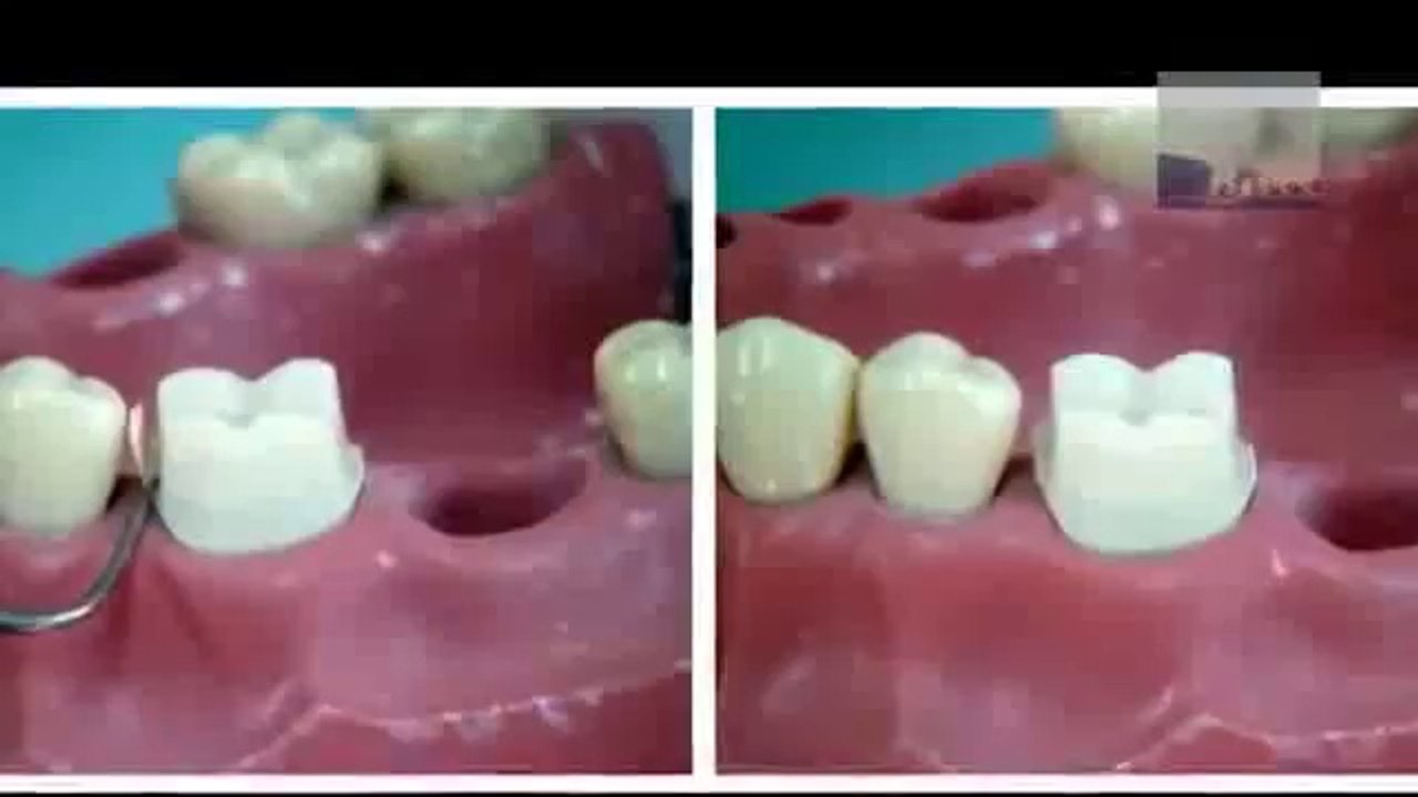 European Clinic of Aesthetic Dentistry in Budapest “Jewel Dental” “AVANTE” Dentist Medical Center Семинар по стоматологии Международная Клиника эстетической стоматологии и дентальной имплантации
