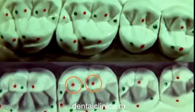 Семинар по стоматологии морфология, hi-tech протезирование, эстетика красивой улыбки Клиника Имплантологии и Эстетической Стоматологии