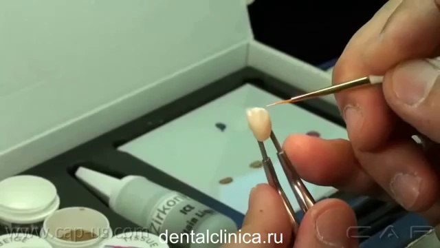 European Clinic Dentistry in Budapest Jewel Dental AVANTE Стоматология реставрация зубов, hi-tech лечение Отзывы пациентов, улыбки на лицах Международная клиника имплантологии и протезирования