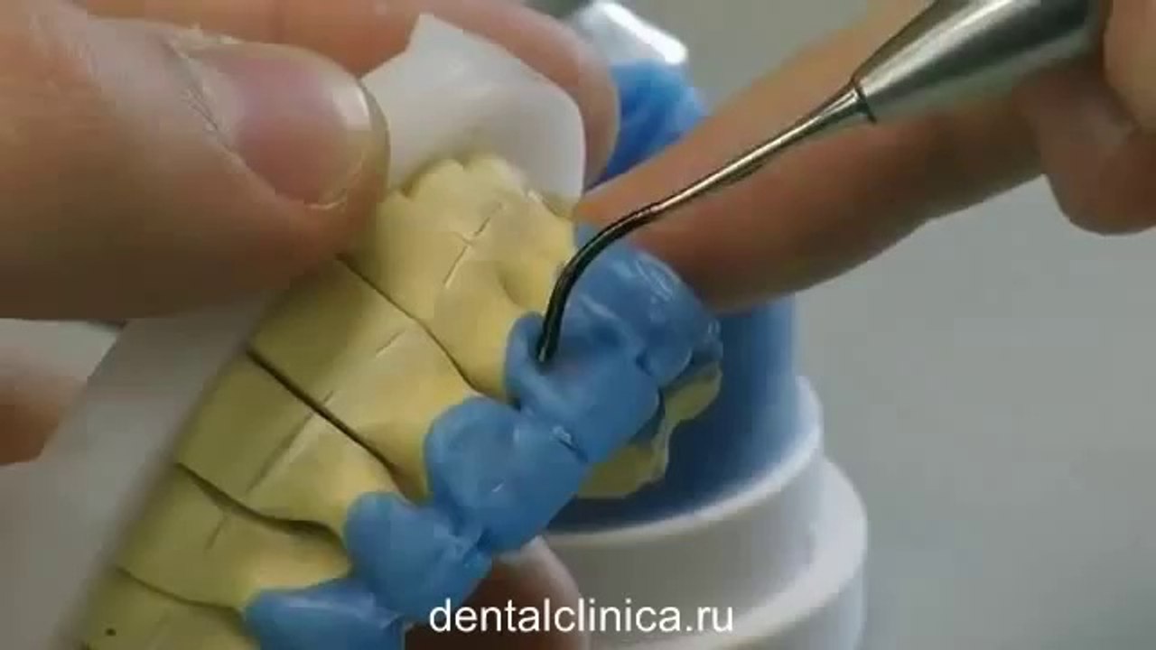 Стоматология, лечение зубов, hi-tech протезирование European Clinic Dentistry in Budapest Jewel Dental AVANTE Международная клиника стоматологии имплантологии