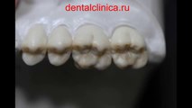 European Clinic  Dentistry in Budapest Jewel Dental AVANTE Dentist Medical Center Эстетическая реконструктивная стоматология, доступные цены отзывы пациентов, улыбки на лицах Клиника Имплантологии и Эстетической Стоматологии
