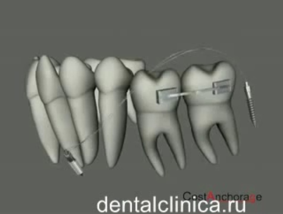 European Clinic  Dentistry in Budapest Jewel Dental AVANTE Dentist Medical Center Эстетическая стоматология Имплантация ортодонтия прикус красивая улыбка Международная клиника имплантологии и протезирования