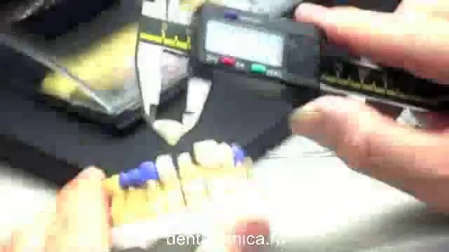 European Clinic Dentistry in Budapest Jewel Dental AVANTE Dentist Medical Center Эстетическая стоматология, создание нового керамического покрытия, видео урок Центр Имплантологии и Ресторативной Стоматологии