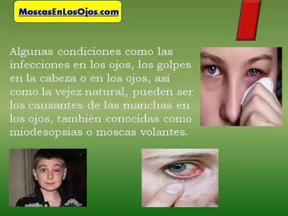 Como Quitar Las Manchas en los Ojos: Como Se Pueden Quitar Las Manchas en los Ojos