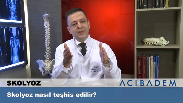 Skolyoz nasıl teşhis edilir?