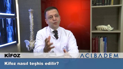 Kifoz nasıl teşhis edilir?