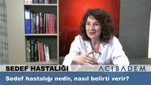 Sedef hastalığı nedir nasıl belirti verir ?