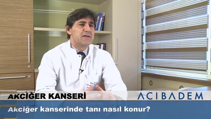 Akciğer kanserinde tanı nasıl konur?
