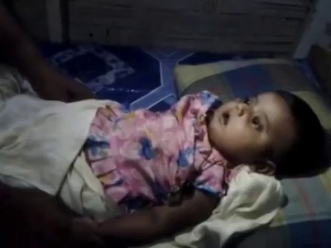 Five Month Old Rohingya baby from Asthma as She was stripped off access to medication