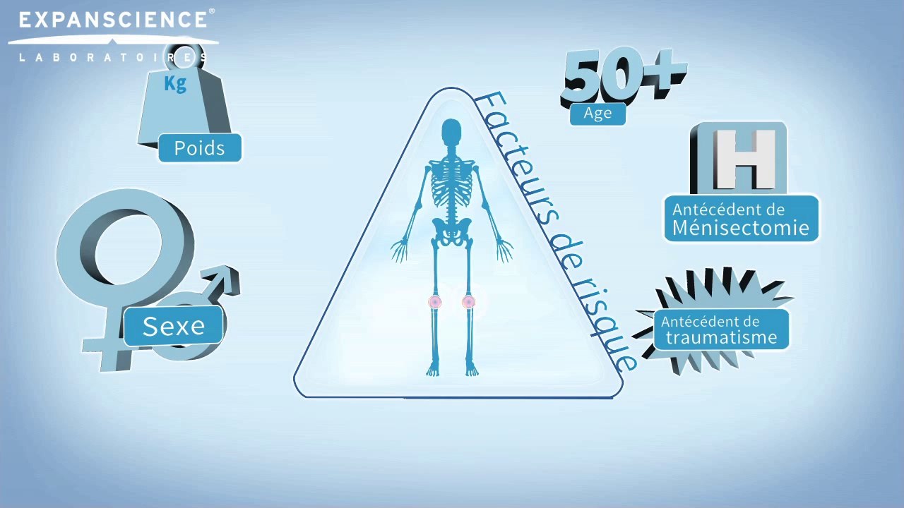 C'est de l'arthrose docteur ? Ai-je de l'arthrose ? | Arthrolink.com