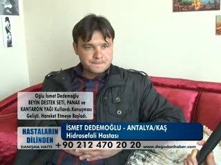 HİDROSEFALİ HASTALIĞI VARDI ŞİFALI BİTKİLERİ KULLANDI