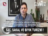 Flash Tv Mehmet GÜÇLÜ AVRUPA SAÇ EKİMİ (hair transplantation)