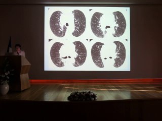 Oesophagus diseases - Dr Naama BOGOT Part 1