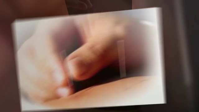 Torrance Acupuncture For In Vitro Fertilization