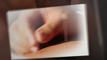 Torrance Acupuncture For In Vitro Fertilization