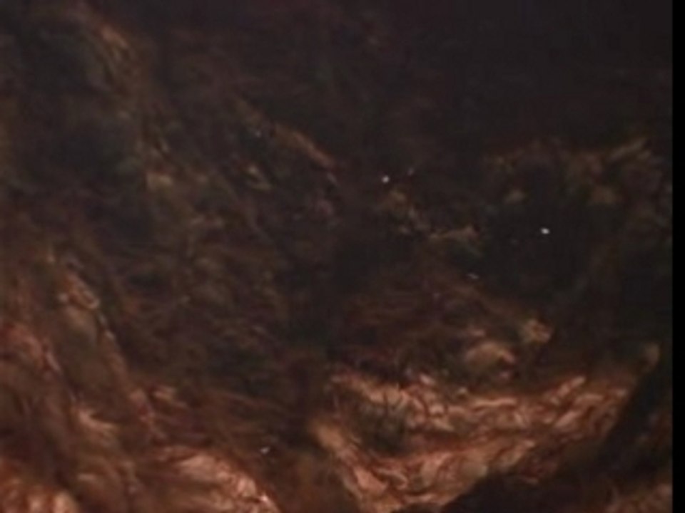 Massive Attack - Teardrop