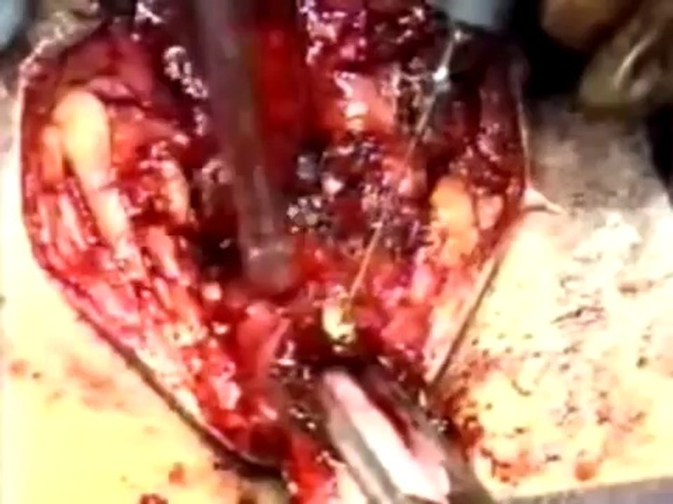 Cirurgia para mudança de sexo ✔