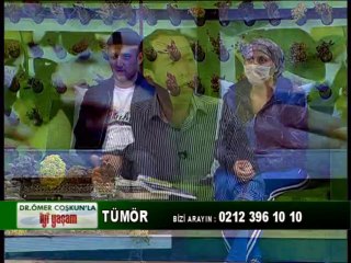 DR ÖMER COŞKUN TÜMÖR HASTALIĞINI ANLATIYOR
