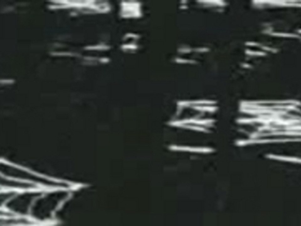 Alan Stivell - Let The Plin