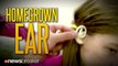HOMEGROWN EAR: Little Girl Gets New Ear Using Cartilage from Own Rib Cage After Raccoon Attack