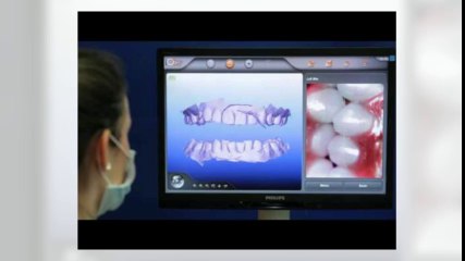 Maple Ridge Invisalign Feb2014