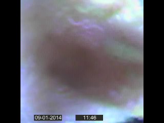 Pis Su Kaçağı Tespiti