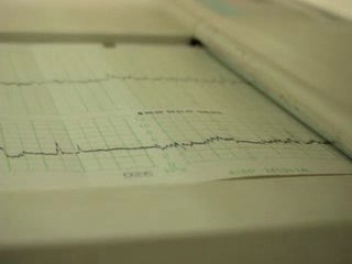 Battements coeur Mahina