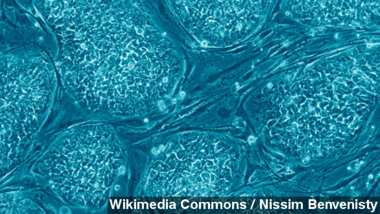 Scientists Create Stem Cells From Adult Skin Cells