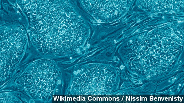 Scientists Create Stem Cells From Adult Skin Cells
