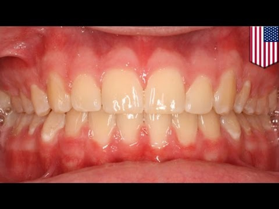 Disgusting! Mother BITES OFF umbilical cord after going on crack binge, giving birth in bathtub