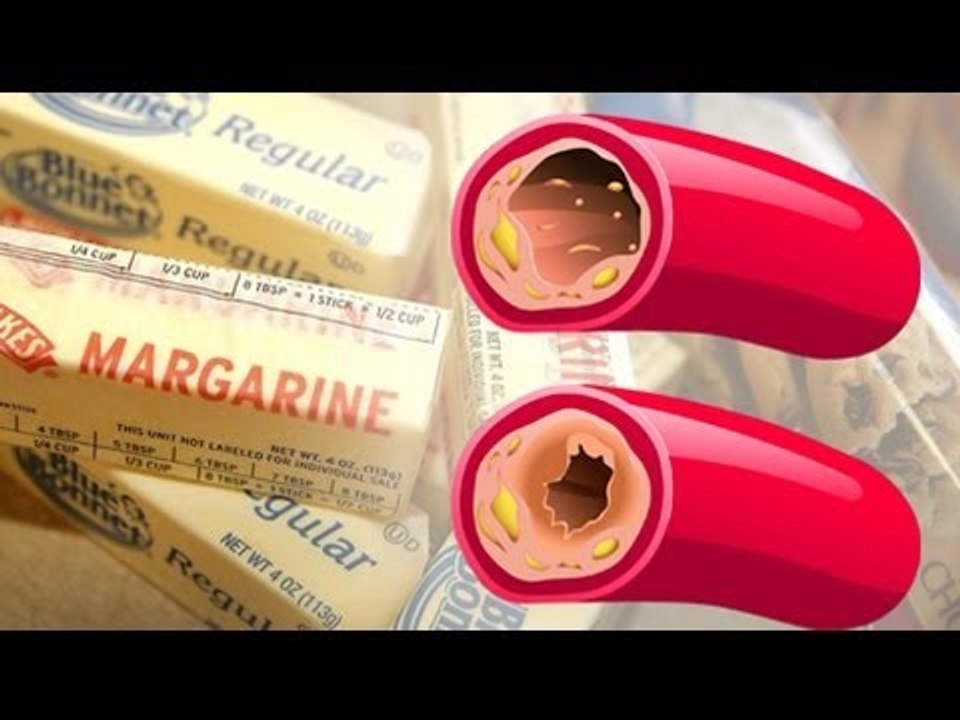 FDA proposes to ban trans fats due to health risks