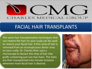 Charles Medical Group: Hair Transplants Surgery in Boca Raton