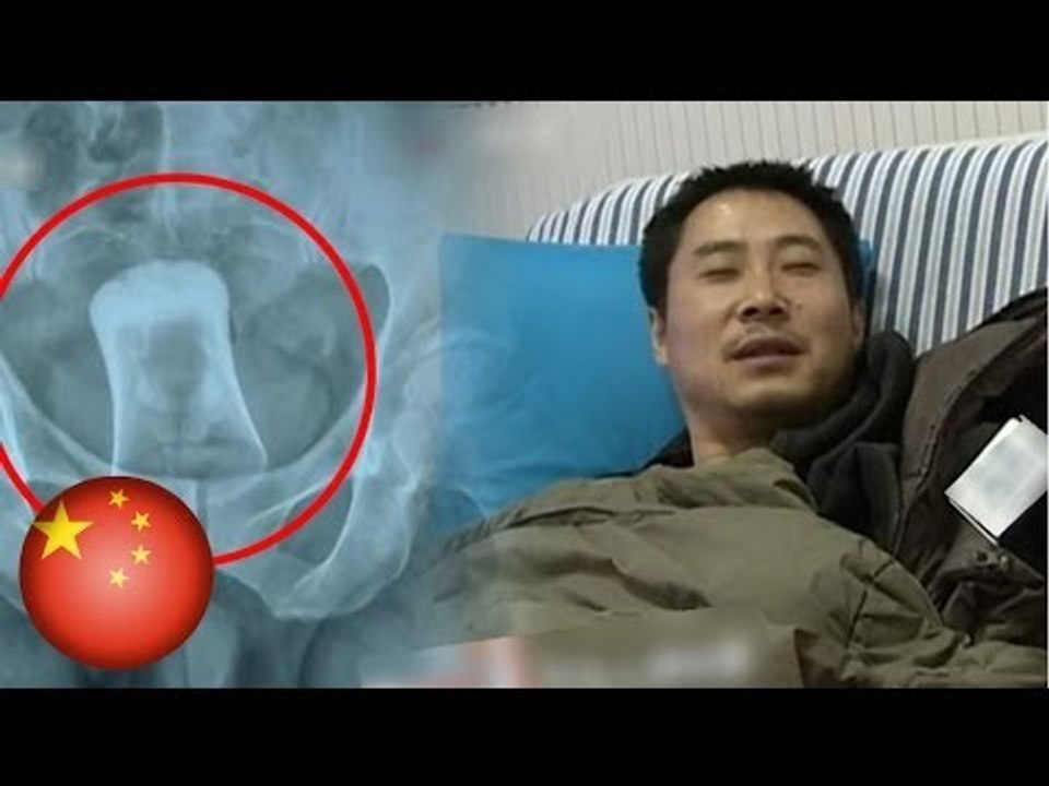 Chinese man allegedly has shot glass shoved up his behind during random attack