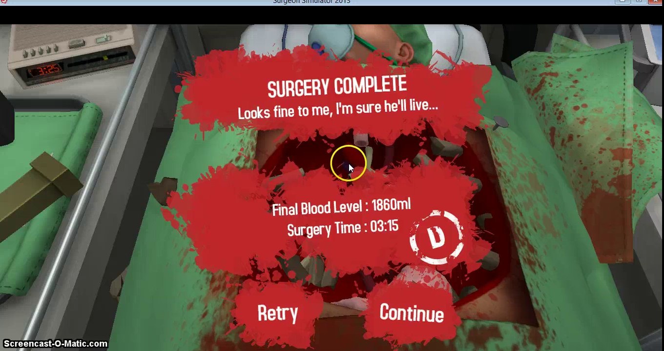 HAMMER TIME! - Surgeon Simulator 2013 - Part 1