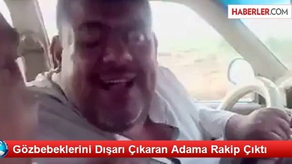 Gözbebeklerini Dışarı Çıkaran Adama Rakip Çıktı