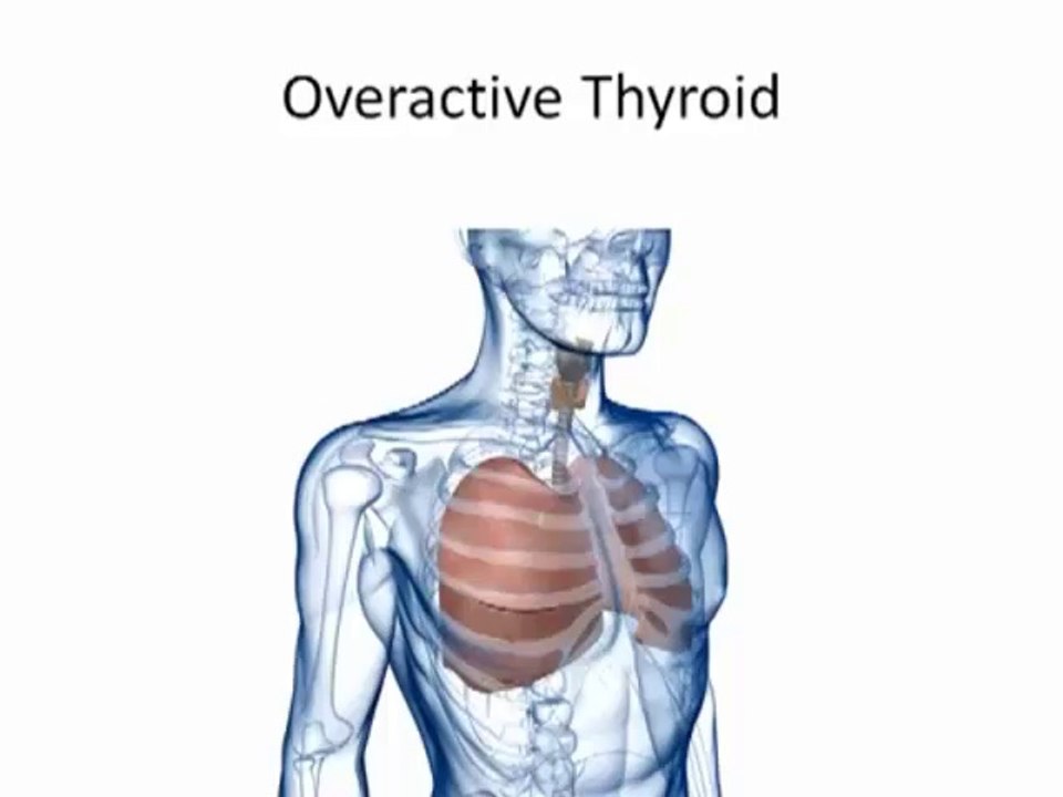 Sweating During Sleep, I Sweat Too Much, Palms Are Sweaty, Sweating In Bed, Girl Sweaty Feet