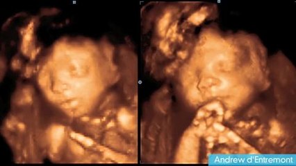 Pregnancy: What to Expect Week 23 -- 3D Imaging