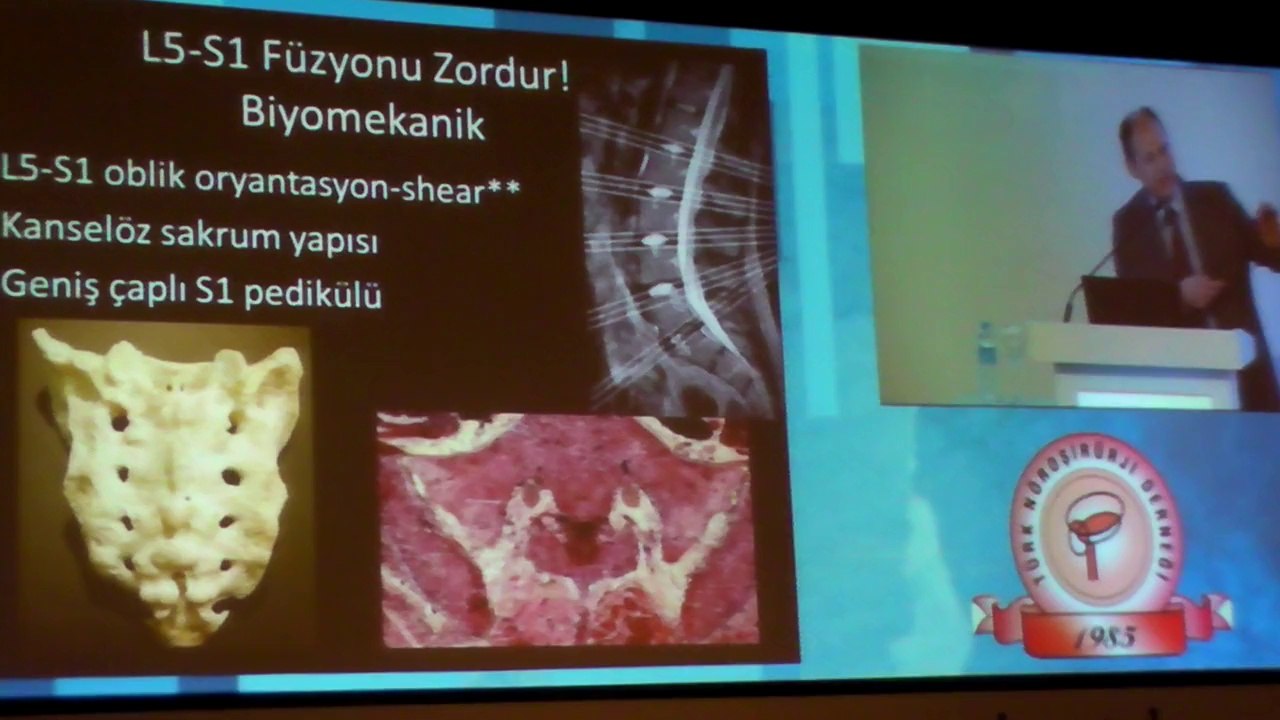 2014 Türk Nöroşirürji Derneği 28 Kongresi Sacro-Pelvik Fiksasyon Prof Dr. Başar Atalay