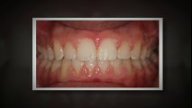 Dallas Orthodontist Apr2014