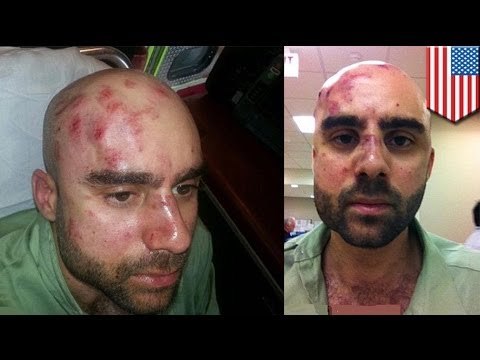Student beats up teacher? Miami-Dade college music teacher brutally beaten 'over bad grade'