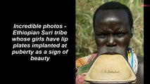 Ethiopian Suri tribe whose girls have lip plates implanted at puberty as a sign of beauty