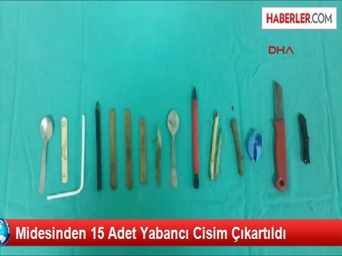 Engelli Çocuğun Midesinden Meyve Bıçağı ve Çay Kaşığı Çıktı