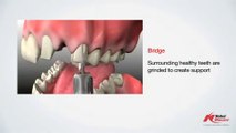 Praxis Dental Clinic - Nobel Biocare Dental Implant Systems for Oral Rehabilitation