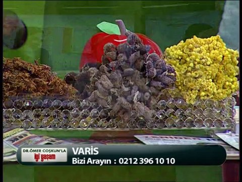 DR ÖMER COŞKUN VARİS HASTALIĞINI ANLATIYOR