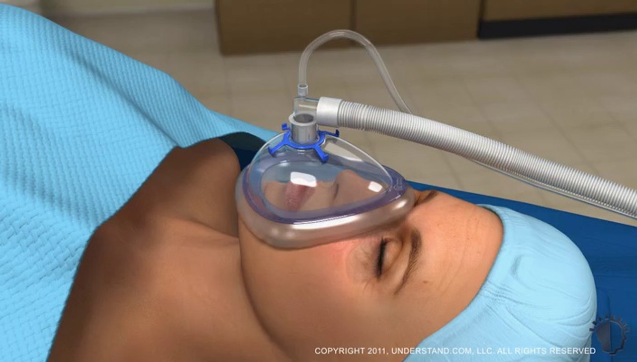 Alt Göz kapağı Cerrahi