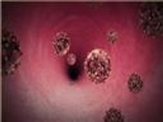 عقار جديد لمرض الحصبة يؤخذ عن طريق الفم