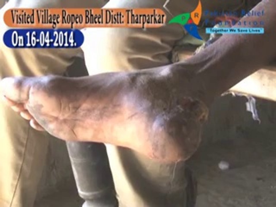 Chairman PRF Haleem Adil Sheikh visited drought affected village Ropeo Bheel on 16.04.2014