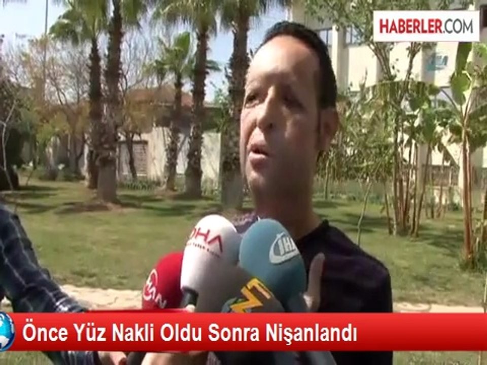 Önce Yüz Nakli Oldu Sonra Nişanlandı