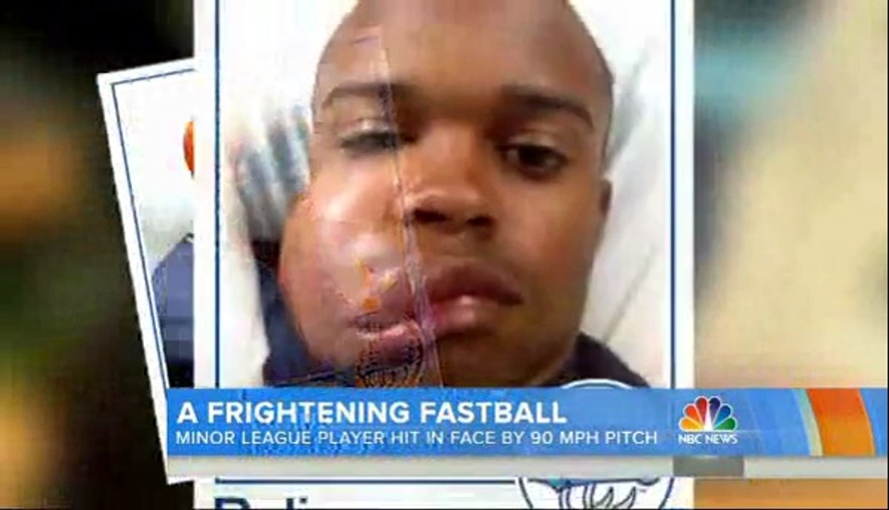 Balle de Baseball en pleine tête : 140km/h!
